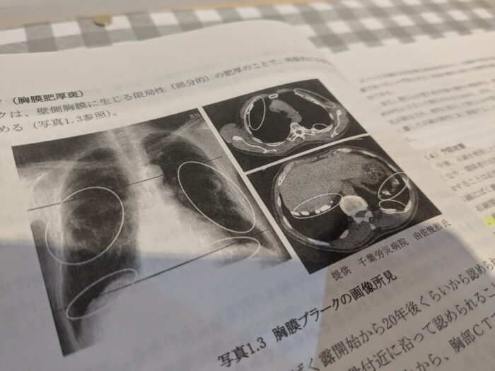 アスベストによる健康被害について